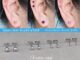 ต่างหูกลมสแตนเลสแท้ 316L [ราคา1คู่] ต่างหูหัวกลมเกรดการแพทย์