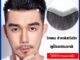 วิกผม สำหรับคนหัวเถิก ใช้ได้ทั้งชายและหญิง V shape และ M shape แฮร์พีช
