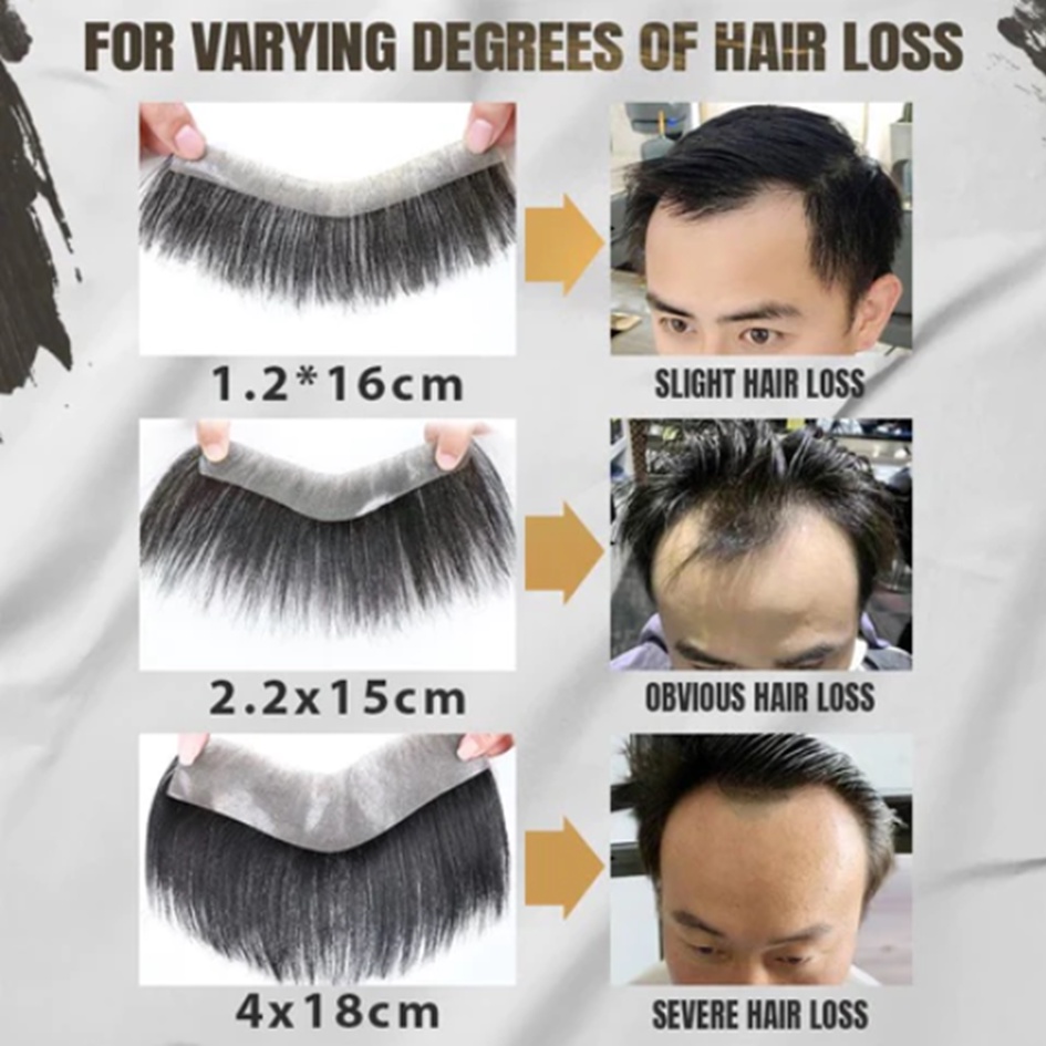 วิกผม สำหรับคนหัวเถิก ใช้ได้ทั้งชายและหญิง V shape และ M shape แฮร์พีช