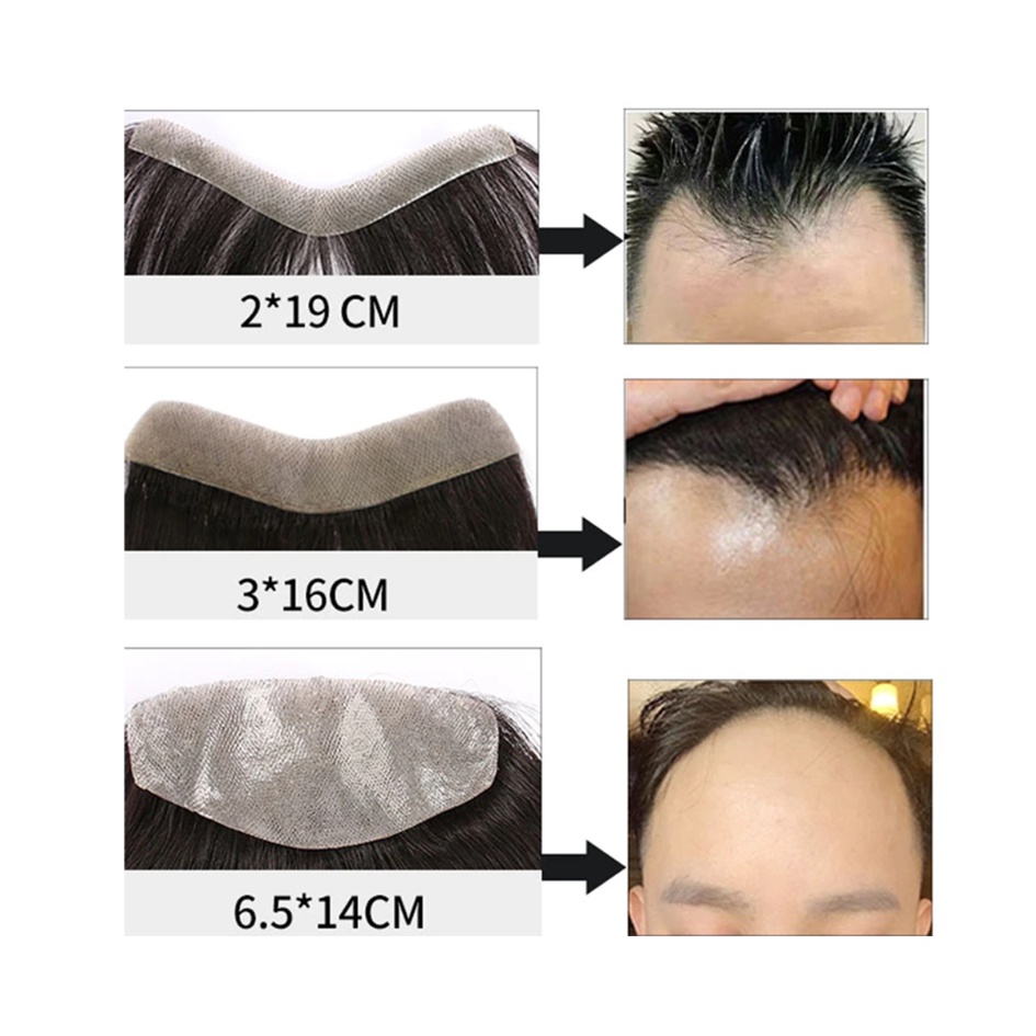 วิกผม สำหรับคนหัวเถิก ใช้ได้ทั้งชายและหญิง V shape และ M shape แฮร์พีช