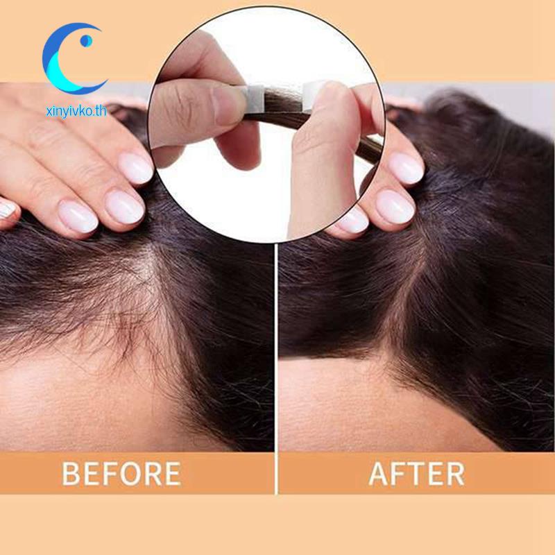 [ขายดี] เทปกาวติดวิกผม ด้านข้าง สําหรับ Toupee 36 ชิ้น