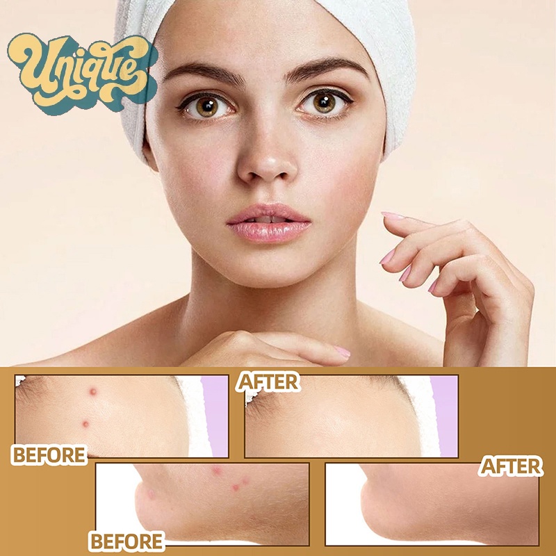 (Unique) ใหม่ สติกเกอร์เทปคอนซีลเลอร์ ปกปิดรอยแผลเป็น รอยสัก กันน้ํา 60 ชิ้น