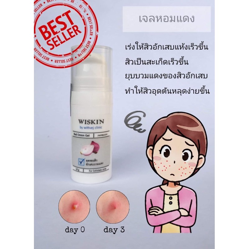 เจลแต้มสิว สิวอักเสบ เจลหอมแดง ใช้จริงในคลินิก กับคนไข้ wiskin byวิธิเวชคลินิก