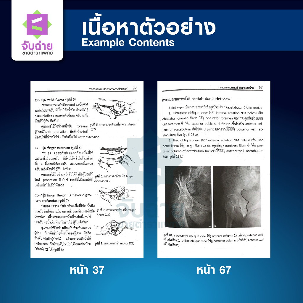 Orthopaedic Secrets (เคล็ดลับทางออร์โธปิดิกส์)