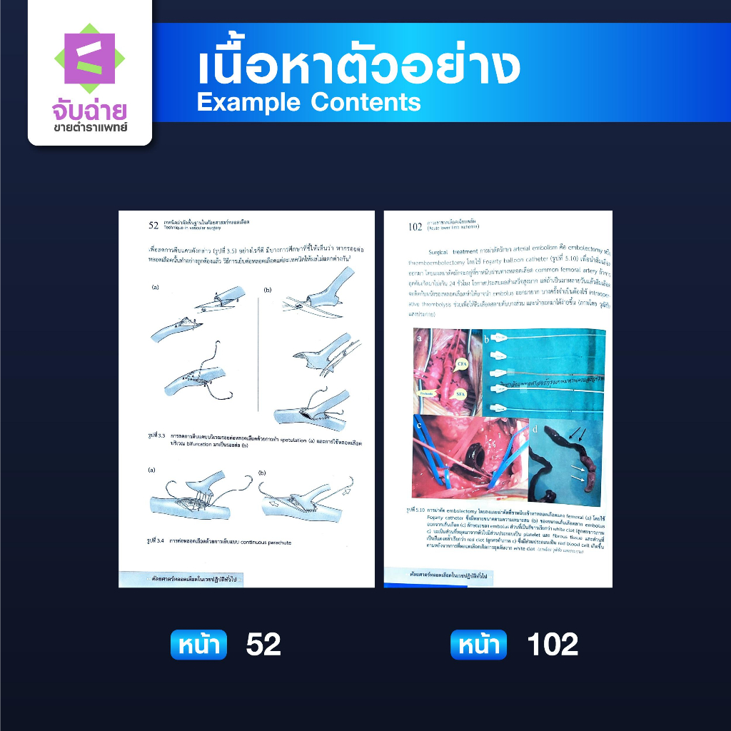 ตำราศัลยศาสตร์หลอดเลือดในเวชปฏิบัติทั่วไป