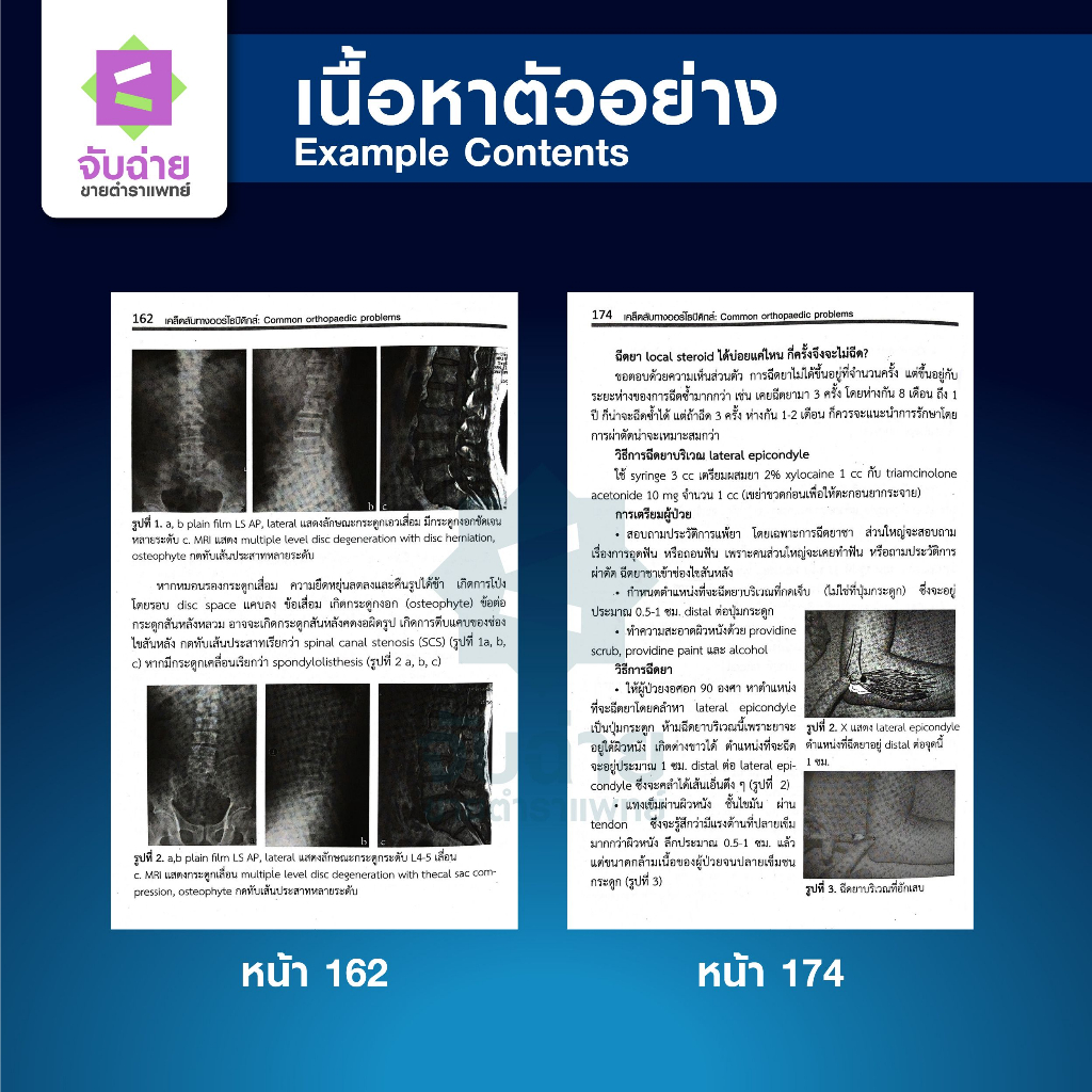 Orthopaedic Secrets (เคล็ดลับทางออร์โธปิดิกส์)