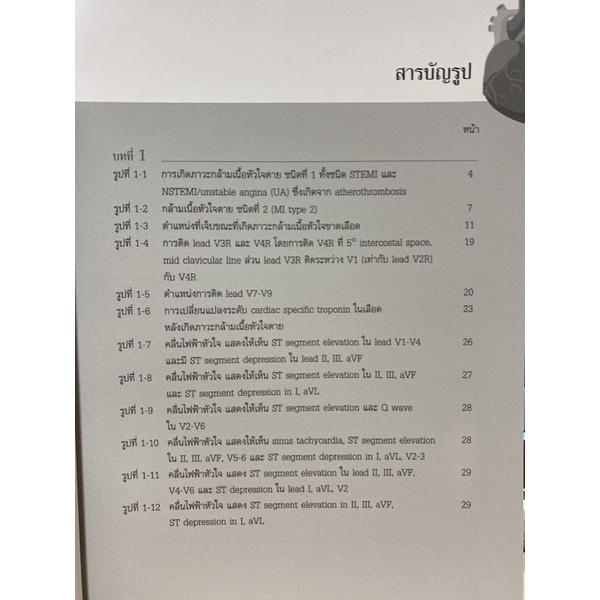 9786165771962 c111 ภาวะกล้ามเนื้อหัวใจขาดเลือดเฉียบพลัน ชนิด STEMI (ACUTE ST-SEGMENT ELEVATION MYOCARDIAL INFARCTION)