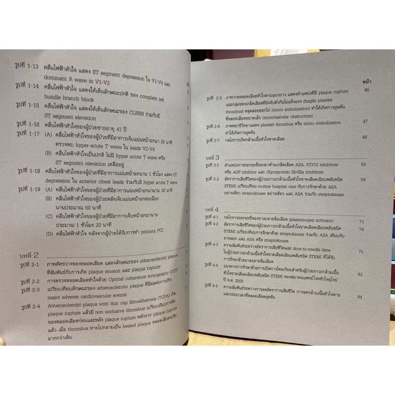 9786165771962 c111 ภาวะกล้ามเนื้อหัวใจขาดเลือดเฉียบพลัน ชนิด STEMI (ACUTE ST-SEGMENT ELEVATION MYOCARDIAL INFARCTION)