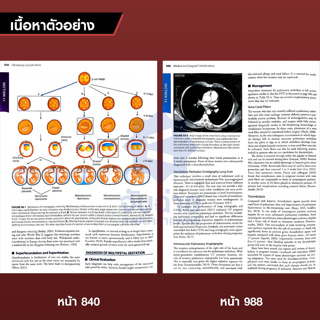 Williams Obstetrics (26ED) (IE)