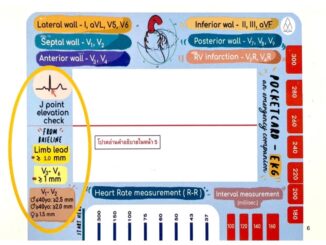 [ขายดี✅] การ์ด Ezy EKG Card คลื่นไฟฟ้าหัวใจ ครอบครัวตัวคลื่น plearn the review book of ecg หนังสือ electrocardiography