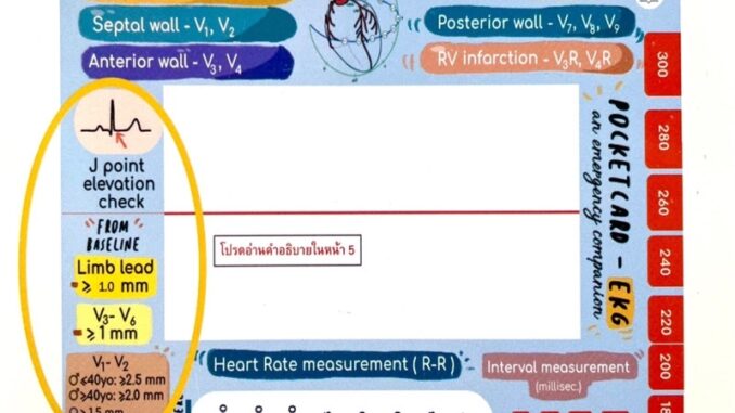 [ขายดี✅] การ์ด Ezy EKG Card คลื่นไฟฟ้าหัวใจ ครอบครัวตัวคลื่น plearn the review book of ecg หนังสือ electrocardiography