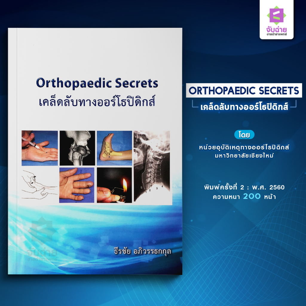 Orthopaedic Secrets (เคล็ดลับทางออร์โธปิดิกส์)